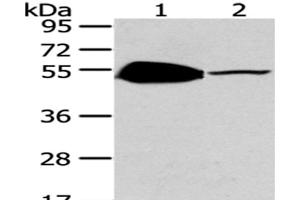 Western Blot analysis of Mouse brain and heart tissue using TSPYL1 Polyclonal Antibody at dilution of 1/200 (TSPYL1 Antikörper)