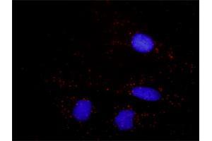 Proximity Ligation Assay (PLA) image for anti-beta-2-Microglobulin (B2M) (AA 1-119) antibody (ABIN560019)