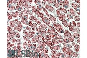 Immunohistochemistry (IHC) image for anti-NADH Dehydrogenase (Ubiquinone) 1 alpha Subcomplex, 7, 14.5kDa (NDUFA7) (Internal Region) antibody (ABIN1049506)