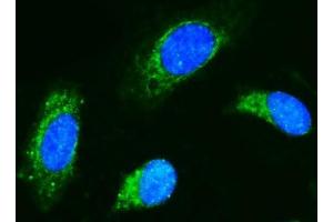 IF analysis of CD89/FCAR using anti-CD89/FCAR antibody (ABIN7600686).