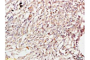 Immunohistochemistry (IHC) image for anti-rho-Associated, Coiled-Coil Containing Protein Kinase 1 (ROCK1) (AA 1001-1200) antibody (ABIN738636)