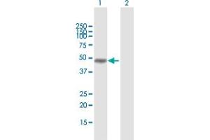 Western Blot analysis of MAGEA8 expression in transfected 293T cell line by MAGEA8 MaxPab polyclonal antibody. (MAGEA8 Antikörper  (AA 1-318))