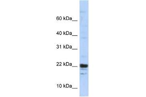 WB Suggested Anti-KIAA0040 Antibody Titration:  0. (KIAA0040 Antikörper  (Middle Region))