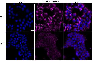 Immunocytochemical staining of HeLa cells using Citrate synthetase antibody (ABIN7798088), 1:1,000), Top panel: wild-type (WT), Bottom panal: Citrate synthetase shRNA knockdown (KD). (Rekombinanter Citrate Synthetase Antikörper)