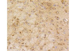 Immunohistochemistry of paraffin-embedded mouse brain using ARRB1 antibody (ABIN5996907) at dilution of 1/100 (40x lens). (beta Arrestin 1 Antikörper)