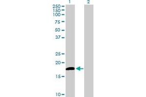Western Blot analysis of DUSP21 expression in transfected 293T cell line by DUSP21 MaxPab polyclonal antibody. (DUSP21 Antikörper  (AA 1-190))