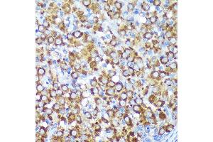 Immunohistochemistry of paraffin-embedded Rat ovary using CYB5R1 Rabbit pAb (ABIN7266630) at dilution of 1:100 (40x lens). (CYB5R1 Antikörper  (AA 1-305))