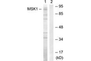 Western blot analysis of extracts from COS7 cells, treated with Sorbitol 0. (MSK1 Antikörper  (AA 331-380))