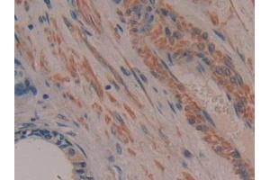 Immunohistochemistry (IHC) image for anti-Mps1 (TTK) (AA 532-786) antibody (ABIN7443260)