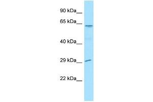 WB Suggested Anti-LGI4 Antibody Titration: 1.