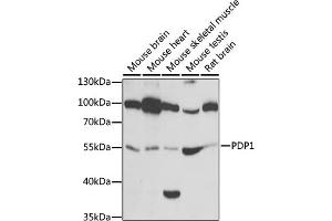 Western blot analysis of extracts of various cell lines, using PDP1 antibody (ABIN6132860, ABIN6145404, ABIN6145405 and ABIN6221944) at 1:1000 dilution. (PDP Antikörper  (AA 278-537))