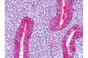 Anti-PAICS / ADE2 antibody IHC staining of human uterus, endometrium. (PAICS Antikörper)