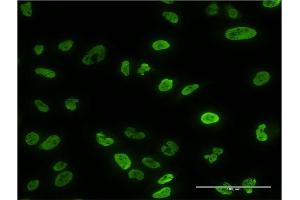 Immunofluorescence (IF) image for anti-Protein Phosphatase 3, Catalytic Subunit, alpha Isoform (PPP3CA) (AA 1-84) antibody (ABIN519132)