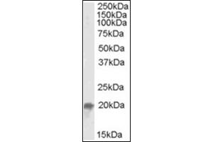 Image no. 2 for anti-Ubiquitin-Conjugating Enzyme E2F (UBE2F) (C-Term) antibody (ABIN375151) (UBE2F Antikörper  (C-Term))