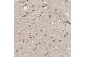 Immunohistochemical staining of human cerebral cortex with DYNLT3 polyclonal antibody  shows moderate cytoplasmic positivity in neuronal cells, glial cells. (DYNLT3 Antikörper)