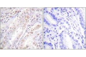 Immunohistochemistry (IHC) image for anti-X-Ray Repair Complementing Defective Repair in Chinese Hamster Cells 2 (XRCC2) (AA 211-260) antibody (ABIN2889293)