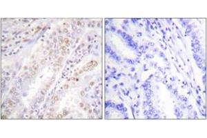 Immunohistochemistry (IHC) image for anti-X-Ray Repair Complementing Defective Repair in Chinese Hamster Cells 2 (XRCC2) (AA 211-260) antibody (ABIN2889293) (XRCC2 Antikörper  (AA 211-260))