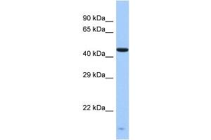 Host:  Rabbit  Target Name:  ZNF701  Sample Type:  Fetal Liver lysates  Antibody Dilution:  1. (ZNF701 Antikörper  (Middle Region))