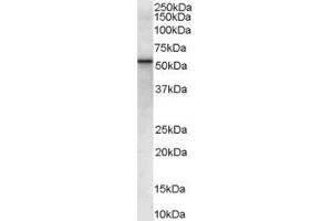ABIN185431 (0. (VPS45 Antikörper  (Internal Region))