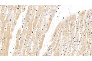 Detection of HIF2a in Human Cardiac Muscle Tissue using Polyclonal Antibody to Hypoxia Inducible Factor 2 Alpha (HIF2a) (EPAS1 Antikörper  (AA 26-347))