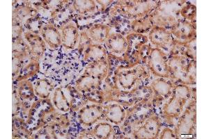 Formalin-fixed and paraffin embedded rat kidney labeled with Rabbit Anti-Lpin1 protein Polyclonal Antibody, Unconjugated  at 1:200 followed by conjugation to the secondary antibody and DAB staining (Lipin 1 Antikörper  (AA 241-340))