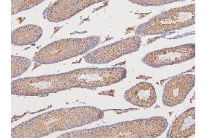 IHC analysis of DAZAP1 using anti-DAZAP1 antibody (ABIN6719309). (DAZAP1 Antikörper  (AA 1-189))
