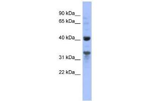 MRPL37 antibody used at 1 ug/ml to detect target protein.