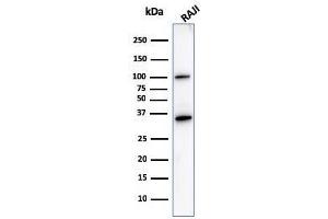 Western Blotting (WB) image for anti-Membrane-Spanning 4-Domains, Subfamily A, Member 1 (MS4A1) antibody (ABIN6941107)