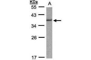 WB Image Sample (30μg whole cell lysate) A:Raji , 12% SDS PAGE antibody diluted at 1:1000 (CDC34 Antikörper)