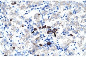 Human kidney; ABT1 antibody - middle region in Human kidney cells using Immunohistochemistry (Activator of Basal Transcription 1 Antikörper  (Middle Region))