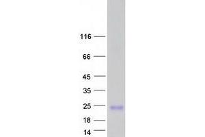 Validation with Western Blot (Small Proline-Rich Protein 2B (SPRR2B) protein (Myc-DYKDDDDK Tag))