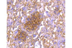 Paraformaldehyde-fixed, paraffin embedded mouse placenta section, Antigen retrieval by boiling in sodium citrate buffer (pH6. (YWHAE Antikörper)