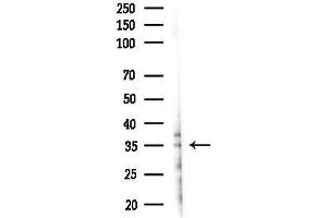 Western blot analysis of lysates from 293 cells(LPS 4h treatment), using Phospho-TIRAP (Tyr106) Antibody at 1/1000 dilution.