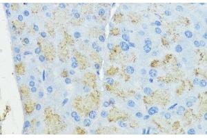 Immunohistochemistry of paraffin-embedded Mouse pancreas using SOD3 Polyclonal Antibody at dilution of 1:100 (40x lens). (SOD3 Antikörper)