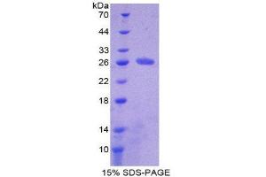 SDS-PAGE (SDS) image for HAUS Augmin-Like Complex, Subunit 7 (HAUS7) (AA 1-227) protein (His tag) (ABIN2121203)