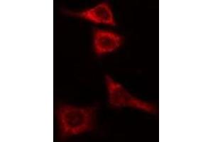 ABIN6274987 staining COLO205 cells by IF/ICC. (CEP135 Antikörper  (C-Term))