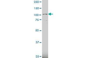 KIAA0317 polyclonal antibody (A01), Lot # 051207JC01 Western Blot analysis of KIAA0317 expression in U-2 OS . (AREL1 Antikörper  (AA 24-123))