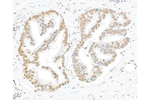 Immunohistochemistry (IHC) image for anti-Replication Protein A2, 32kDa (RPA2) (pSer4), (pSer8) antibody (ABIN7449013) (RPA2 Antikörper  (pSer4, pSer8))