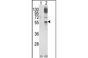 Western blot analysis of GATA2 (arrow) using rabbit polyclonal GATA2 Antibody (Center) (ABIN652243 and ABIN2841006). (GATA2 Antikörper  (AA 262-288))