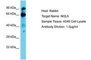 Image no. 1 for anti-Nucleolar Protein 9 (NOL9) (AA 74-123) antibody (ABIN6750676) (NOL9 Antikörper  (AA 74-123))