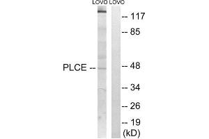 Western Blotting (WB) image for anti-1-Acylglycerol-3-Phosphate O-Acyltransferase 5 (Lysophosphatidic Acid Acyltransferase, Epsilon) (AGPAT5) (Internal Region) antibody (ABIN1850516) (AGPAT5 Antikörper  (Internal Region))