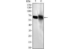 Western blot analysis using ALPI mouse mAb against HL60 (1) and HepG2 (2) cell lysate. (Intestinal Alkaline Phosphatase Antikörper  (AA 397-458))