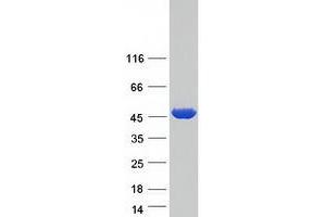 Validation with Western Blot (PSAT1 Protein (Transcript Variant 1) (Myc-DYKDDDDK Tag))