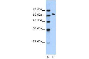 WB Suggested Anti-SUPT16H Antibody Titration: 1. (SUPT16H Antikörper  (N-Term))