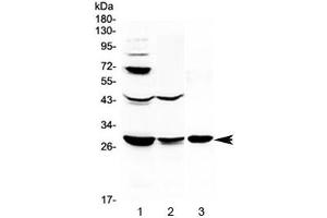 Western blot testing of 1) rat liver, 2) rat kidney and 3) mouse kidney lysate with TL1A antibody at 0. (TNFSF15 Antikörper)