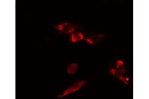 ABIN6274466 staining HuvEc cells by IF/ICC. (MKL1 Antikörper  (N-Term))