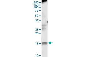 Immunoprecipitation (IP) image for anti-Nuclear Factor of Activated T-Cells, Cytoplasmic, Calcineurin-Dependent 2 Interacting Protein (NFATC2IP) (AA 1-138) antibody (ABIN529820)