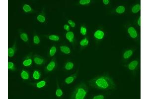 Immunofluorescence analysis of A549 cell using UBE2V1 antibody. (UBE2V1 Antikörper)
