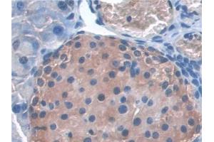 Detection of SNAP23 in Mouse Pancreas Tissue using Polyclonal Antibody to Synaptosomal Associated Protein 23 kDa (SNAP23)