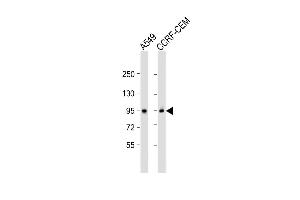 All lanes : Anti-CD71 Antibody (C-term) at 1:2000 dilution Lane 1: A549 whole cell lysate Lane 2: CCRF-CEM whole cell lysate Lysates/proteins at 20 μg per lane. (Transferrin Receptor Antikörper  (C-Term))